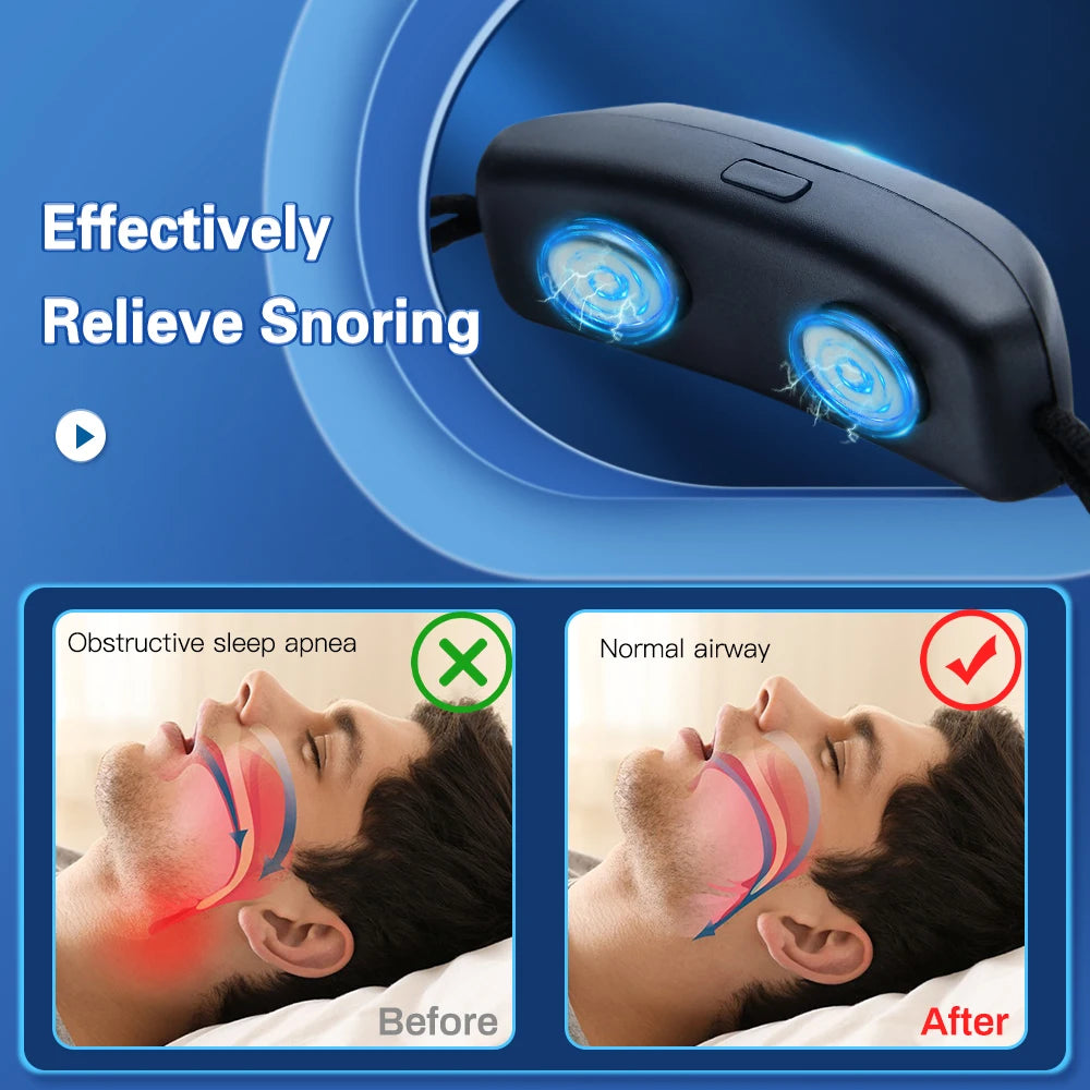 EMS Pulse Stop Snore Portable Comfortable Sleep Well Stop Snore Health Care Sleep Apnea Aid USB Smart Anti Snoring Device