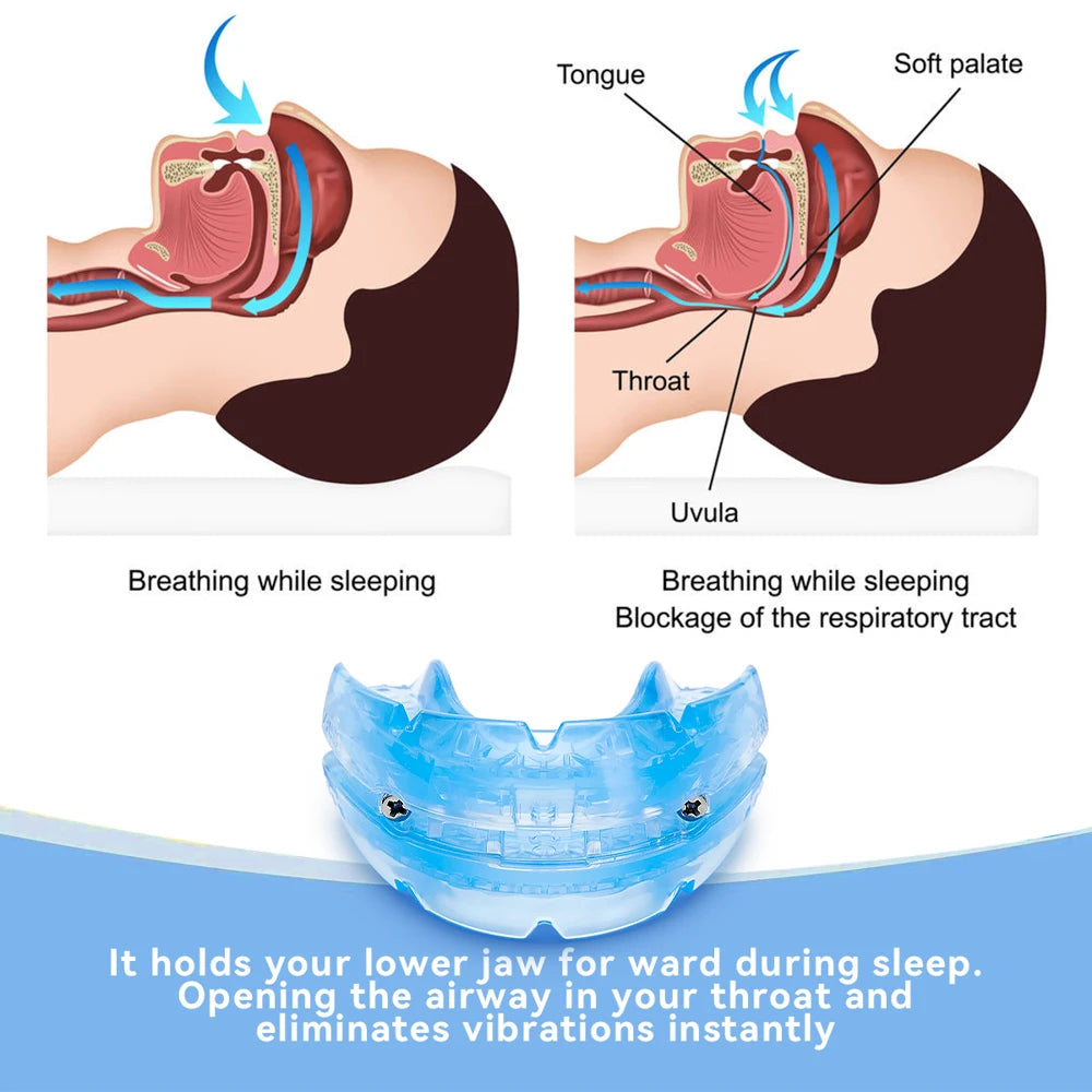 Adjustable Anti Snoring Mouthpiece Device Night Teeth Mouthguard Sleeping Aid Guard Bruxism Stop Snoring Device Improve Sleep