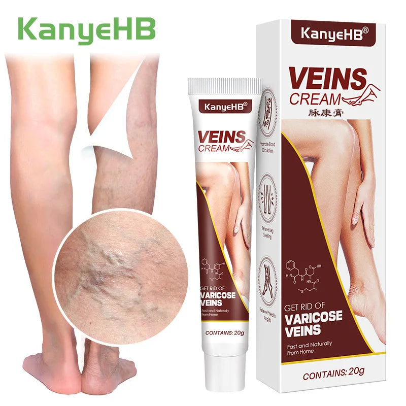 20g Varicose Vein Relief Cream Improves Blood Circulation Relaxing Leg Cream Relieve Spider Blood Vessels Anti Varicose Cream