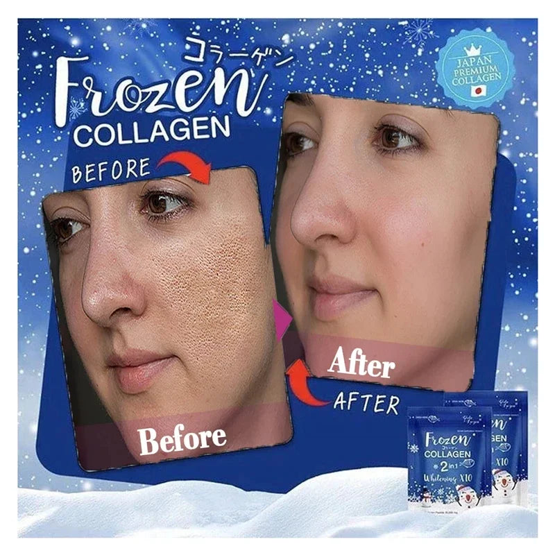 Frozen collagen anti continuity stickers,  anti acne, freckles, skin gloss, 300 pieces